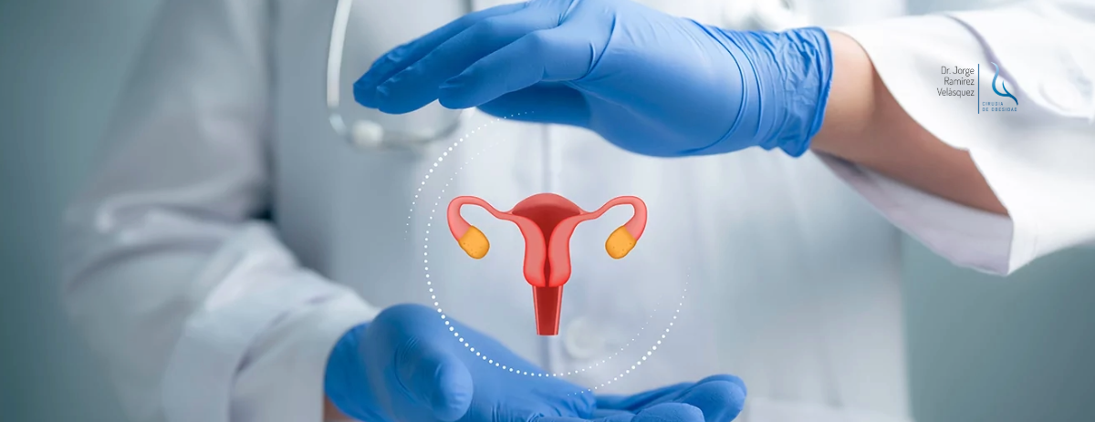 De la Frustración al Control: Mujeres con SOP que Transformaron su Vida con Cirugía de Obesidad